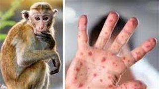 الصحة العالمية تعلن أعلى مستوى من التأهب لمواجهة جدرى القردة – جريدة الخبر اليوم