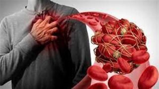 استشاري يكشف العلاقة بين الحر وزيادة نسبة الإصابة بالجلطات – جريدة الخبر اليوم