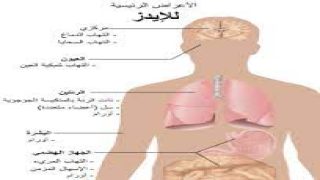 فيروس نقص المناعة البشري (الإيدز).